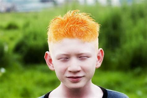 Albino Boy With Orange Hair In Kathmandu Nepal Photographer Leonard