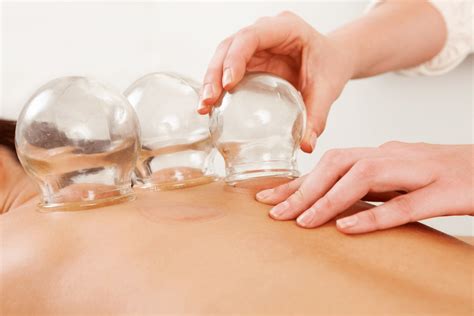 Cupping Therapy By Evolve Spa Boutique Eagle Ranch