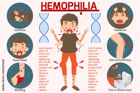 Hemophilia Symptom Infographics Elements Sign And Symbols Of Hemophilia Health And Medical
