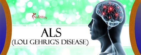 Als Lou Gehrigs Disease Treatment Abroad