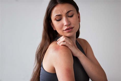 Dealing With Stress Rash Causes Symptoms And Treatment Options