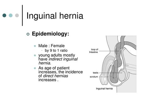 Inguinal Hernia Surgical Anatomy