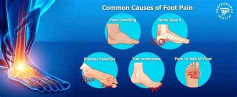 Top Causes For Foot Pain And How To Avoid Them Performance Health