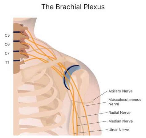 Brachial Plexus Injury Everything You Need To Know