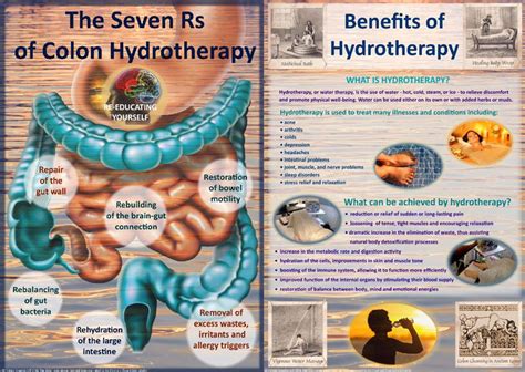 Show Patients Clients Posters Explaining Hydrotherapy Colonics
