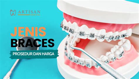 Gigi Jongang Pakai Braces Archives Artisan Dental
