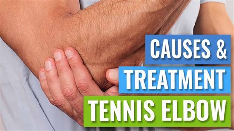 Tennis Elbow Treatment Youtube