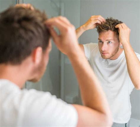 Everything You Need To Know About Male Pattern Baldness Or Baldness In