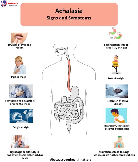 Achalasia: Signs & Symptoms | Signs and symptoms, Symptoms, Signs