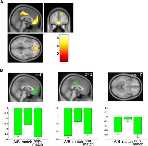 Brain Regions Involved In Matching Expected And Observed Perceptual