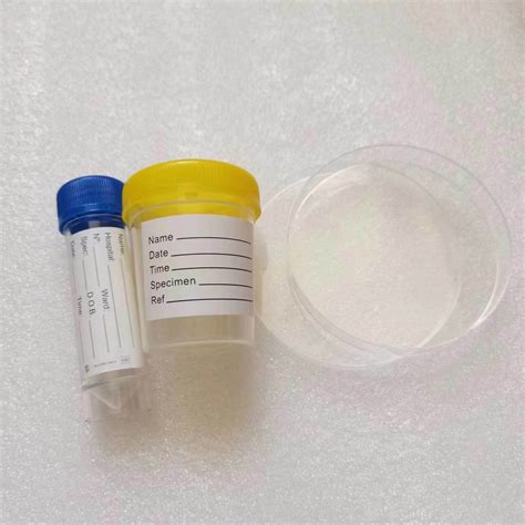 Disposable Medical Sterile 60ml Urine Conatiner Specimen Cup China