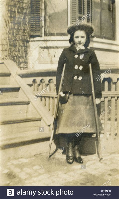 1905 Photograph Edwardian Girl With Crutches New England
