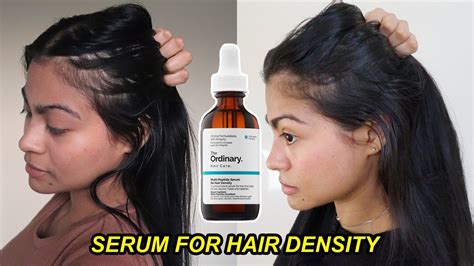 I Tried The Ordinary Serum For Hair Density For 4 Months And This