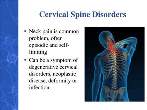 Ppt Cervical Spine Surgery 101 Powerpoint Presentation Free Download