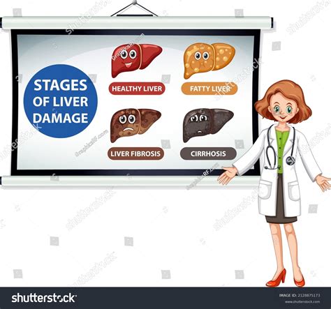 Diagram Showing Stages Liver Damage Illustration Stock Vector Royalty