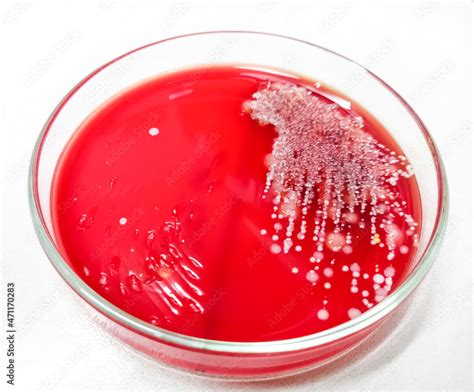 Staphylococcus Aureus Gram Positive Bacteria Nonmotile Beta