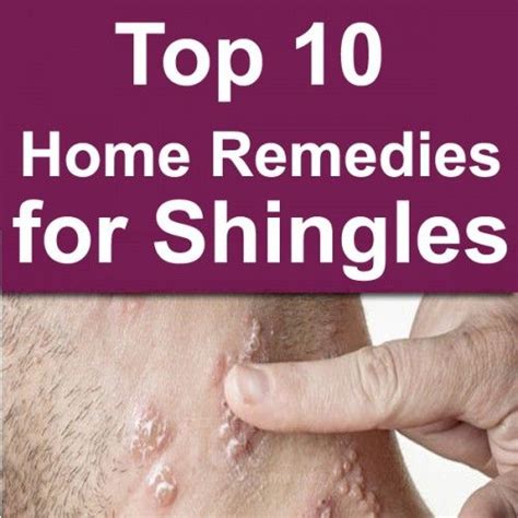 Top 10 Home Remedies For Shingles Home Remedies Top 10 Home Remedies