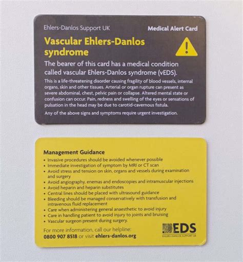 Vascular Eds Medical Alert Card Online Shop For The Ehlers Danlos
