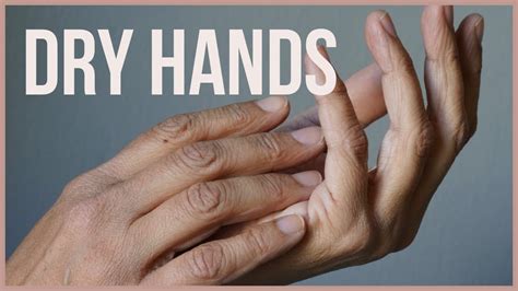 How To Treat Your Dry Hands With Oils Youtube