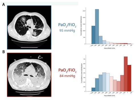 To be sure, icmr doesn't mandate. There may be two separate types of COVID-19 pneumonia that ...