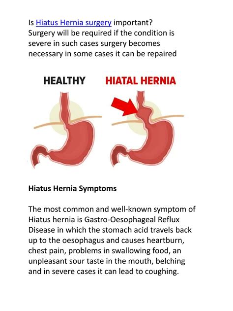 Ppt Hiatus Hernia Explained And A Possible Way Cure Powerpoint