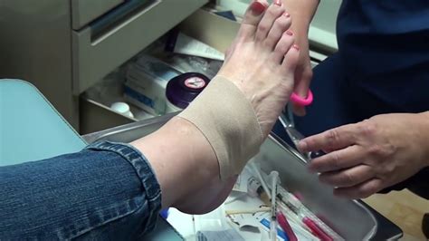 What Causes A Ganglion Cyst On Your Foot And Ankle Podiatry Hotline Reverasite