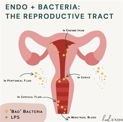 Dysbiosis And Endometriosis The Reproductive Tract — Heal Endo
