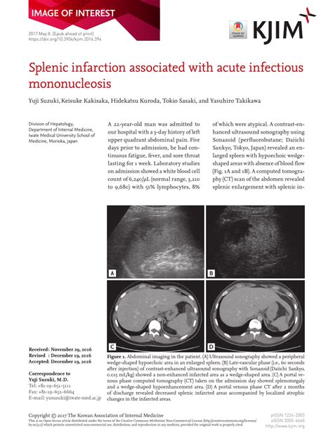 Pdf Splenic Infarction Associated With Acute Infectious Mononucleosis