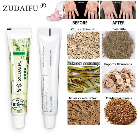 Zudaifu Skin Psoriasis Cream Dermatitis Eczematoid Eczema Ointment