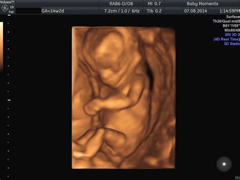 4d Baby Scan Done At The Clinic Baby Moments Baby Ultrasound Baby