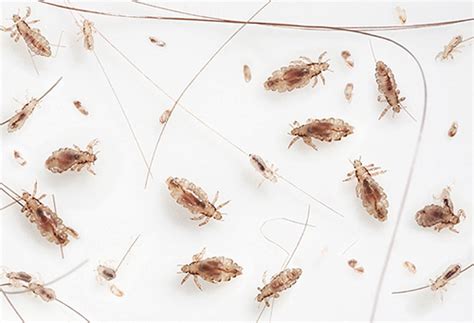 Head Lice Photos And Features Of Biology