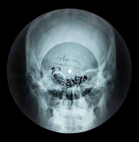 Russian X Rays On Vinyl Bones Skull X Ray Vinyl Vinyl Records