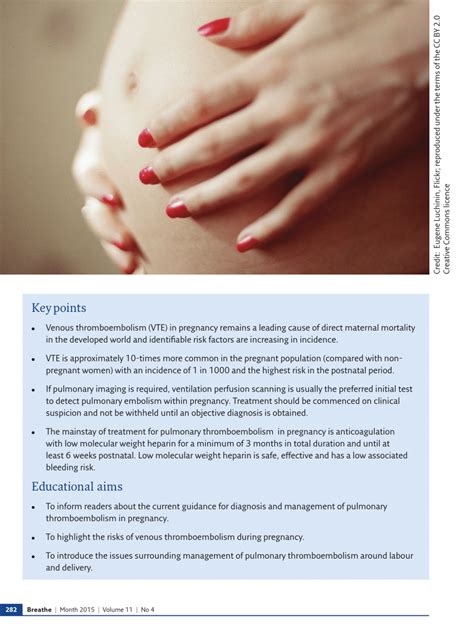 PDF Pulmonary Thrombo Embolism In Pregnancy Diagnosis And Management