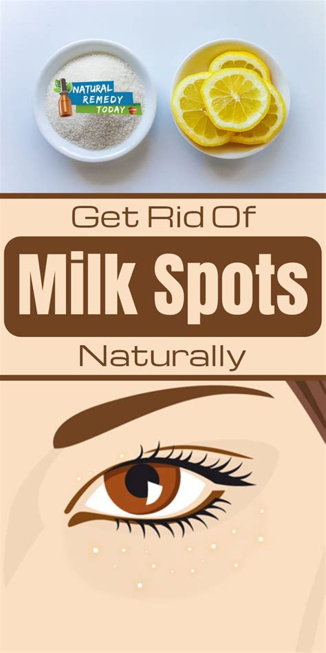 White spots in the skin can result from melatonin becoming absent in the area, as a result of vitamin b12 deficiency. White Spots + White Spots on face + White Spots recipes ...