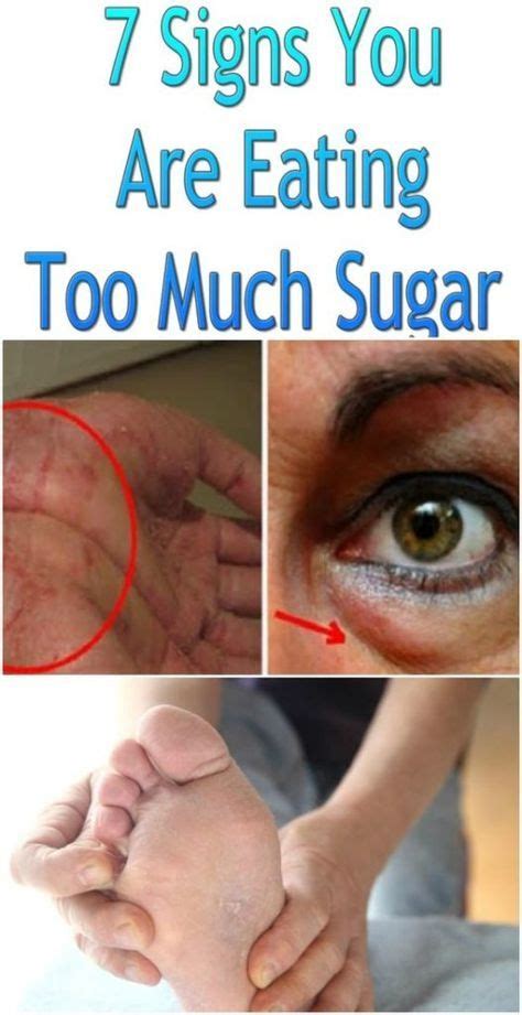 These 9 Signs You Are Eating Too Much Sugar Mayawebworld Natural Therapy Health Diet
