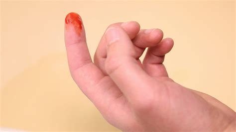 Blood Covered Finger Confirms Nose In Fact Bleeding