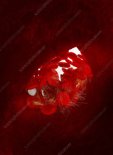Blood Clot Artwork Stock Image C0164620 Science Photo Library
