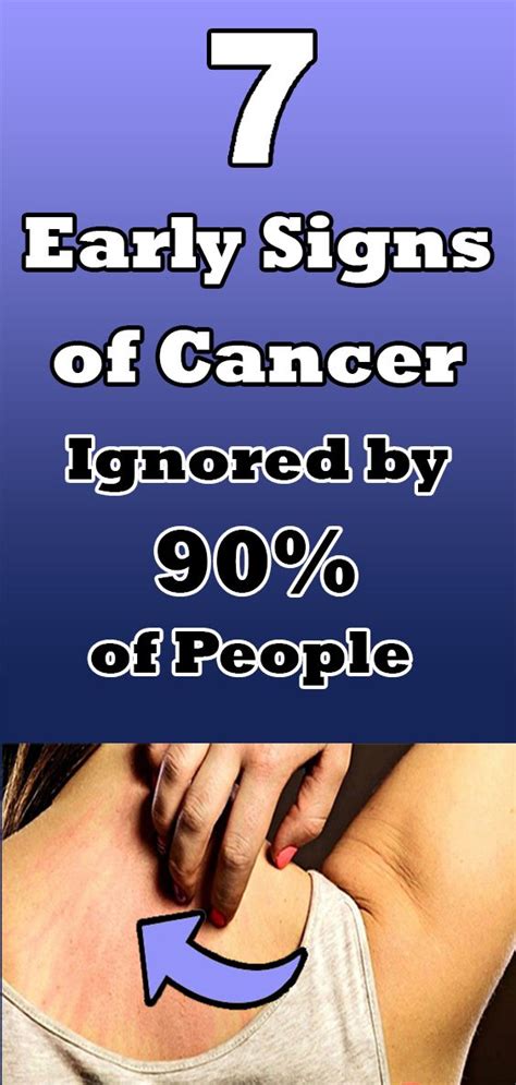 7 Early Signs Of Cancer Ignored By 90 Of People Healthcare Solo