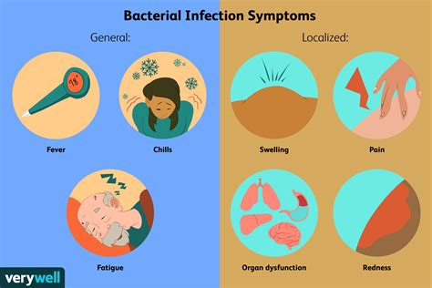 Bacterial Infections Symptoms Causes Diagnosis And Treatment
