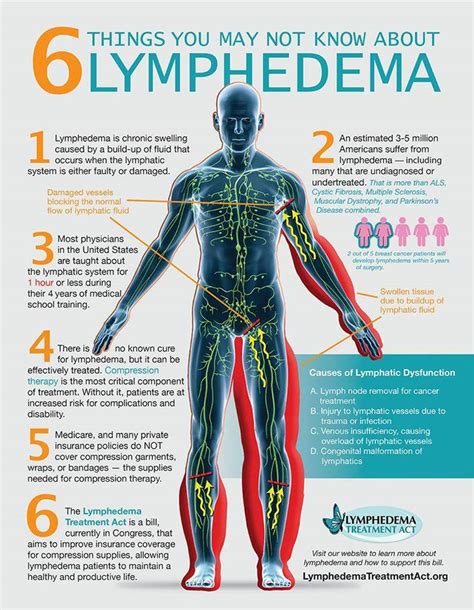Lymphedema Treatment