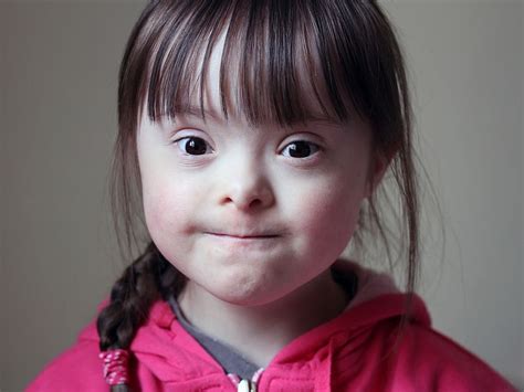 Child With Down Syndrome A Positive Experience
