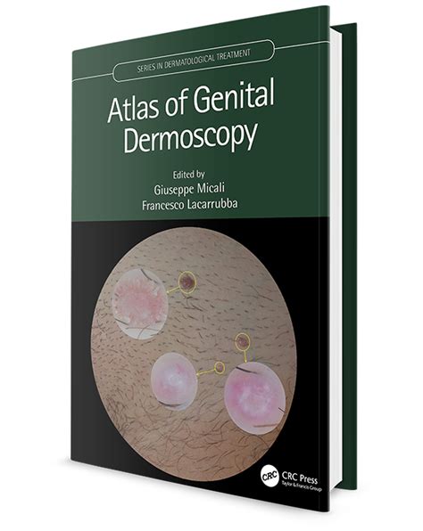 Atlas Of Genital Dermoscopy Archidemia