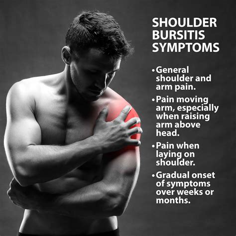 Shoulder Bursitis Causes Symptoms Treatment Shoulder Bursitis My Xxx