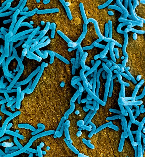 People can get evd through direct contact with an infected animal (bat or nonhuman primate) or a sick or dead person infected with ebola virus. Marburg Virus Particles | Colorized scanning electron ...