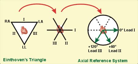 Check spelling or type a new query. CV Physiology: Standard Limb Leads (Bipolar)