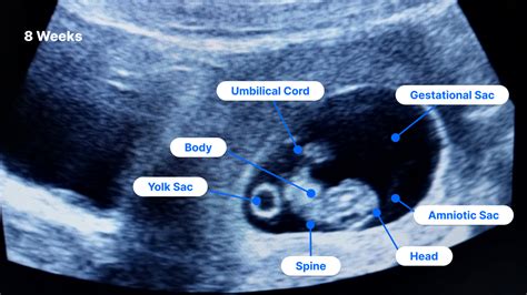 8 Weeks Pregnant Ultrasound Pockethealth