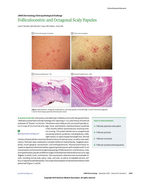 Folliculocentric And Octagonal Scaly Papules Dermatology Jama