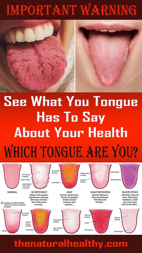 what your tongue can tell you about your health the pins populer 2