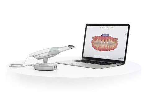 Itero Intraoral Scanner For Dental Treatments At Mahimaa Dental Care