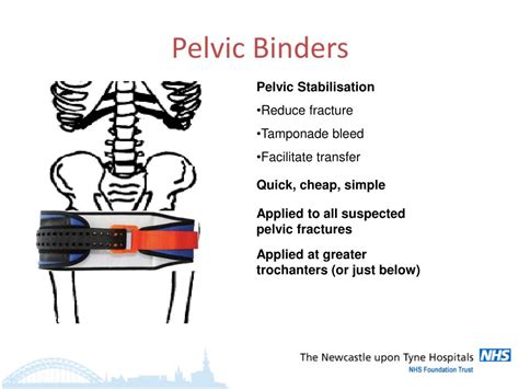 Ppt Emergency Management Of Pelvic Fractures An Audit Of Practice